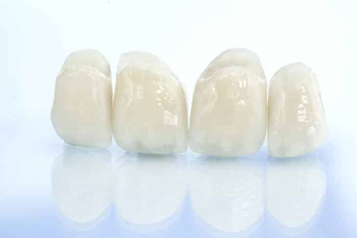crowns